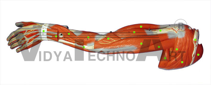 Lateral View-Deep Shoulder